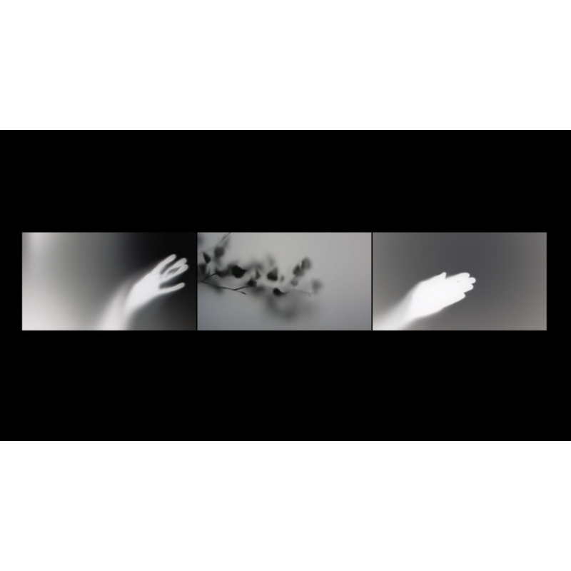 Long survivor 02 – Transplant